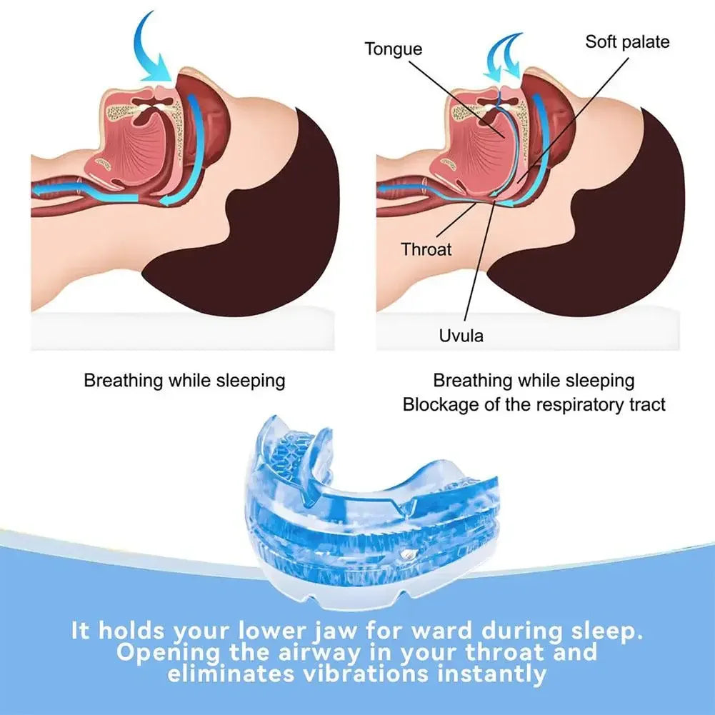 Anti Snoring Mouth Guard Improve Sleeping Adjustable Snoring Mouth Guard Anti-Apnea Teeth Bruxism Stop Snoring Device Mouthpiece